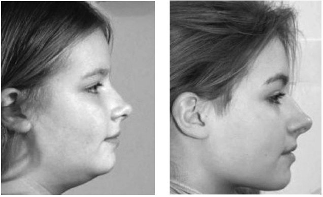 Иллюстрация к книге — Укус эволюции. Откуда у современного человека неправильный прикус, кривые зубы и другие деформации челюсти [i_008.jpg]