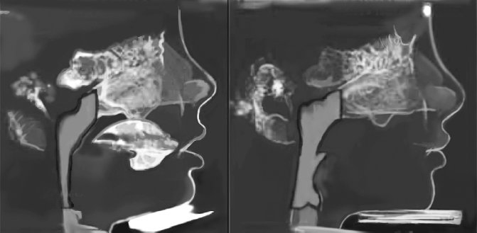 Иллюстрация к книге — Укус эволюции. Откуда у современного человека неправильный прикус, кривые зубы и другие деформации челюсти [i_009.jpg]