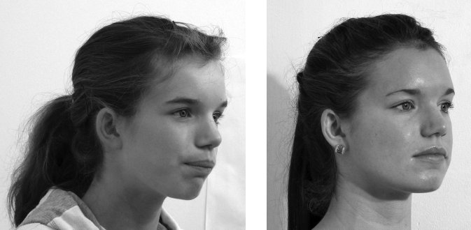 Иллюстрация к книге — Укус эволюции. Откуда у современного человека неправильный прикус, кривые зубы и другие деформации челюсти [i_010.jpg]