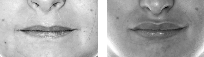 Иллюстрация к книге — Укус эволюции. Откуда у современного человека неправильный прикус, кривые зубы и другие деформации челюсти [i_011.jpg]