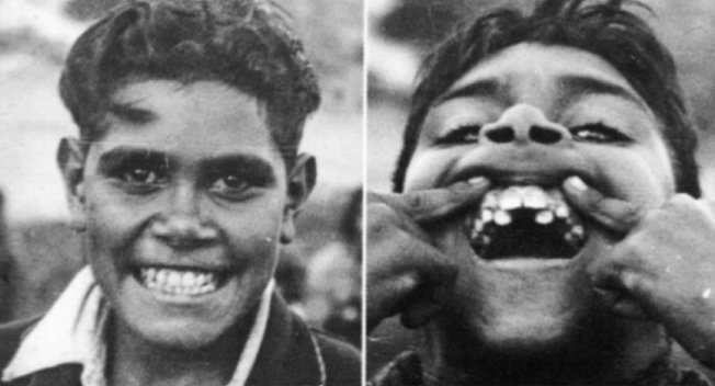 Иллюстрация к книге — Укус эволюции. Откуда у современного человека неправильный прикус, кривые зубы и другие деформации челюсти [i_016.jpg]