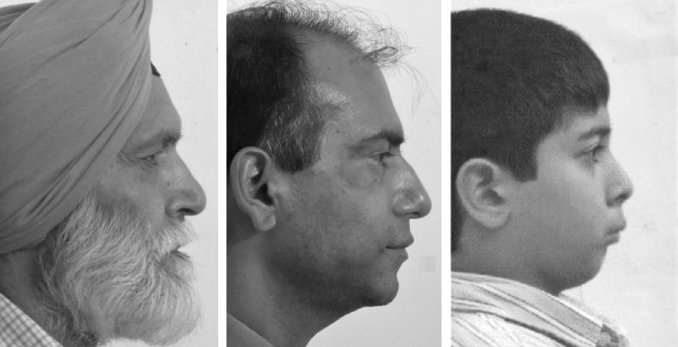 Иллюстрация к книге — Укус эволюции. Откуда у современного человека неправильный прикус, кривые зубы и другие деформации челюсти [i_017.jpg]