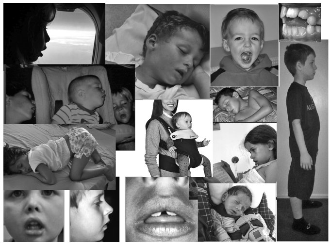 Иллюстрация к книге — Укус эволюции. Откуда у современного человека неправильный прикус, кривые зубы и другие деформации челюсти [i_024.jpg]