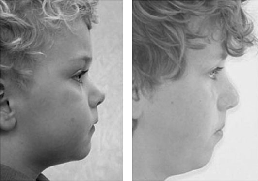 Иллюстрация к книге — Укус эволюции. Откуда у современного человека неправильный прикус, кривые зубы и другие деформации челюсти [i_025.jpg]