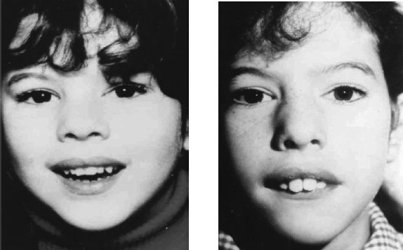 Иллюстрация к книге — Укус эволюции. Откуда у современного человека неправильный прикус, кривые зубы и другие деформации челюсти [i_026.jpg]