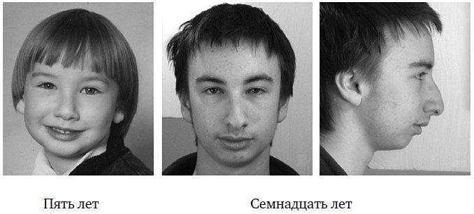 Иллюстрация к книге — Укус эволюции. Откуда у современного человека неправильный прикус, кривые зубы и другие деформации челюсти [i_035.jpg]