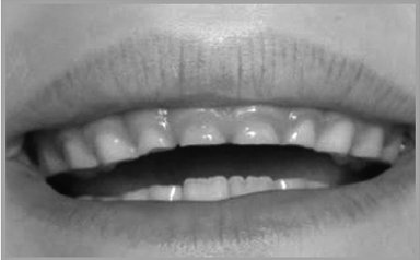 Иллюстрация к книге — Укус эволюции. Откуда у современного человека неправильный прикус, кривые зубы и другие деформации челюсти [i_038.jpg]