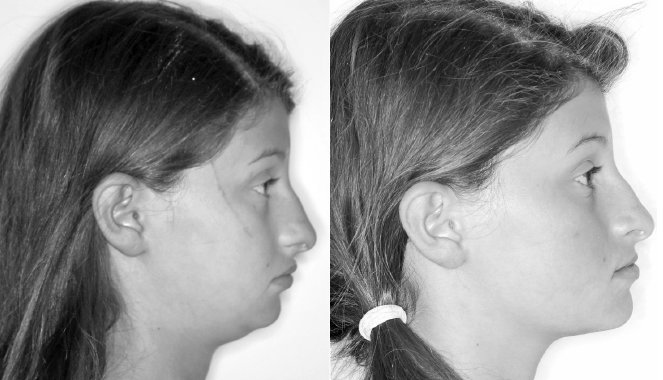 Иллюстрация к книге — Укус эволюции. Откуда у современного человека неправильный прикус, кривые зубы и другие деформации челюсти [i_057.jpg]