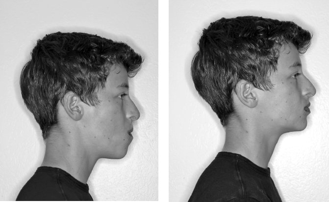 Иллюстрация к книге — Укус эволюции. Откуда у современного человека неправильный прикус, кривые зубы и другие деформации челюсти [i_059.jpg]