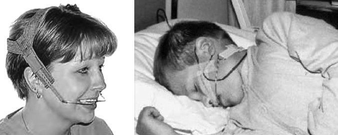 Иллюстрация к книге — Укус эволюции. Откуда у современного человека неправильный прикус, кривые зубы и другие деформации челюсти [i_065.jpg]