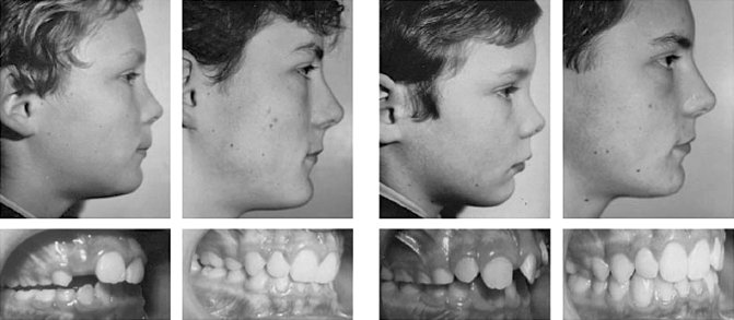 Иллюстрация к книге — Укус эволюции. Откуда у современного человека неправильный прикус, кривые зубы и другие деформации челюсти [i_068.jpg]