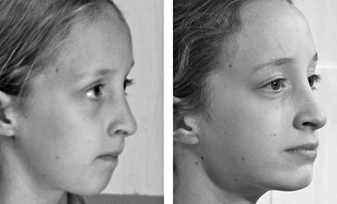 Иллюстрация к книге — Укус эволюции. Откуда у современного человека неправильный прикус, кривые зубы и другие деформации челюсти [i_070.jpg]