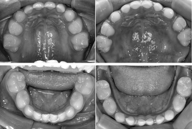 Иллюстрация к книге — Укус эволюции. Откуда у современного человека неправильный прикус, кривые зубы и другие деформации челюсти [i_072.jpg]