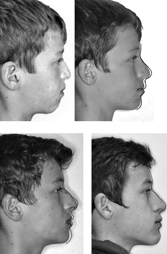 Иллюстрация к книге — Укус эволюции. Откуда у современного человека неправильный прикус, кривые зубы и другие деформации челюсти [i_075.jpg]