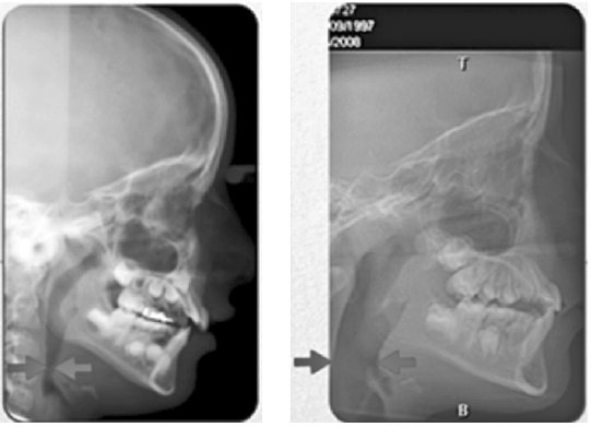 Иллюстрация к книге — Укус эволюции. Откуда у современного человека неправильный прикус, кривые зубы и другие деформации челюсти [i_076.jpg]