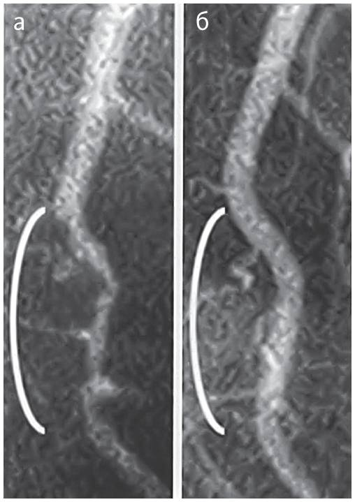 Иллюстрация к книге — Китайское исследование [i_035.jpg]