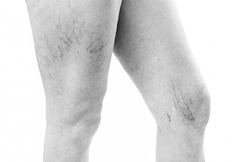 Иллюстрация к книге — Внутривенно. Что происходит с сосудами, по которым движется ваша кровь, как вылечить то, что уже болит, и не допустить проблем в будущем [i_005.jpg]