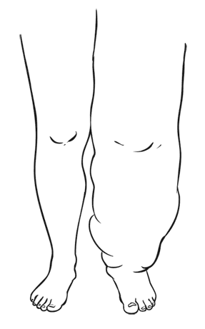 Иллюстрация к книге — Внутривенно. Что происходит с сосудами, по которым движется ваша кровь, как вылечить то, что уже болит, и не допустить проблем в будущем [i_020.jpg]