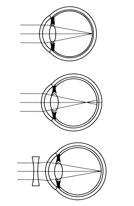 Иллюстрация к книге — Сохраните зрение! Лечебная гимнастика по Фохтину против близорукости, дальнозоркости, глаукомы, катаракты [i_012.jpg]