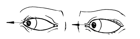 Иллюстрация к книге — Сохраните зрение! Лечебная гимнастика по Фохтину против близорукости, дальнозоркости, глаукомы, катаракты [i_020.jpg]