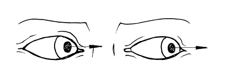 Иллюстрация к книге — Сохраните зрение! Лечебная гимнастика по Фохтину против близорукости, дальнозоркости, глаукомы, катаракты [i_021.jpg]