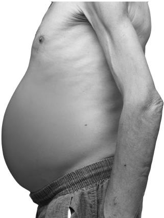 Иллюстрация к книге — О чем молчит печень. Как уловить сигналы самого крупного внутреннего органа, который предпочитает оставаться в тени [i_020.jpg]