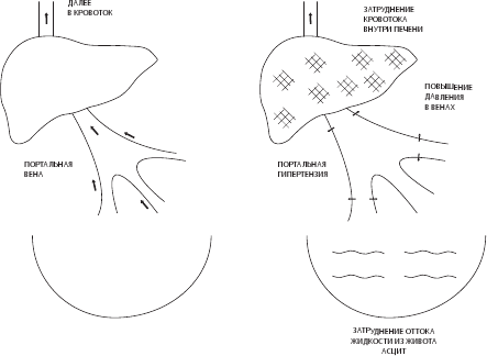 Иллюстрация к книге — О чем молчит печень. Как уловить сигналы самого крупного внутреннего органа, который предпочитает оставаться в тени [i_084.jpg]