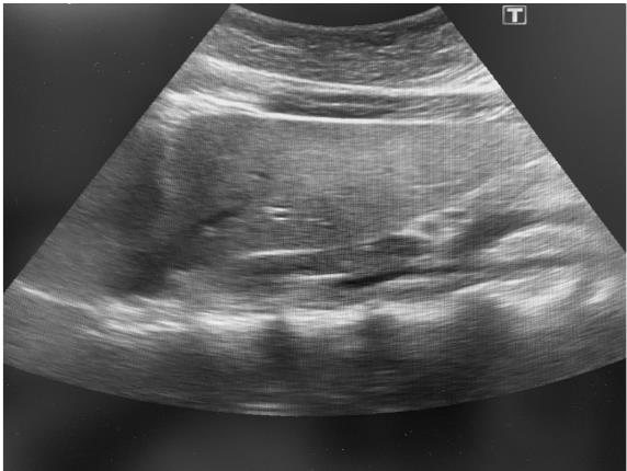 Иллюстрация к книге — О чем молчит печень. Как уловить сигналы самого крупного внутреннего органа, который предпочитает оставаться в тени [i_096.jpg]