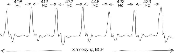Иллюстрация к книге — Блуждающий нерв. Что это такое и за что отвечает? Как воздействие на самый загадочный канал тела поможет преодолеть тревожность и улучшить самочувствие [i_007.jpg]
