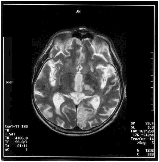 Иллюстрация к книге — Деменция. Диагностика и лечение [i_004.jpg]