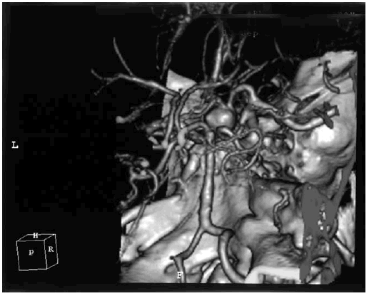 Иллюстрация к книге — Деменция. Диагностика и лечение [i_005.jpg]