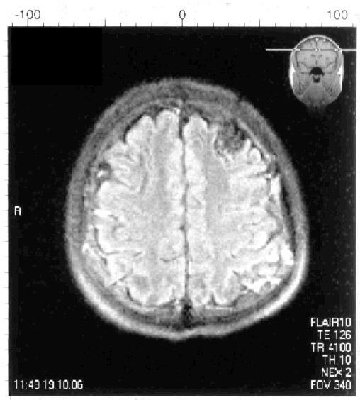 Иллюстрация к книге — Деменция. Диагностика и лечение [i_006.jpg]