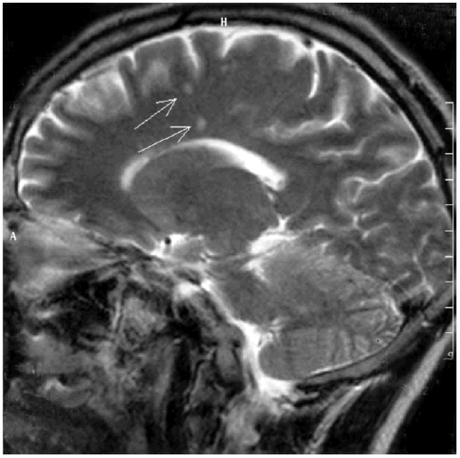 Иллюстрация к книге — Деменция. Диагностика и лечение [i_008.jpg]
