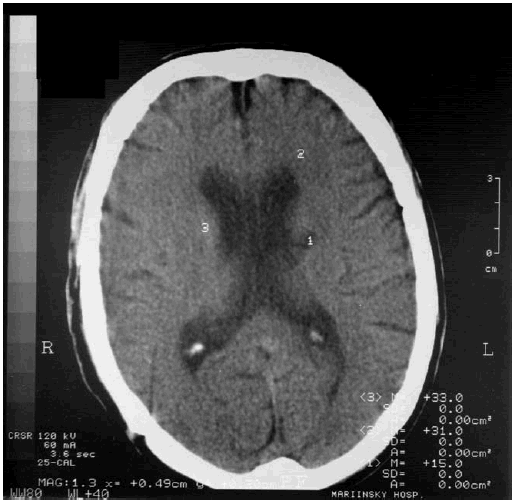 Иллюстрация к книге — Деменция. Диагностика и лечение [i_009.jpg]