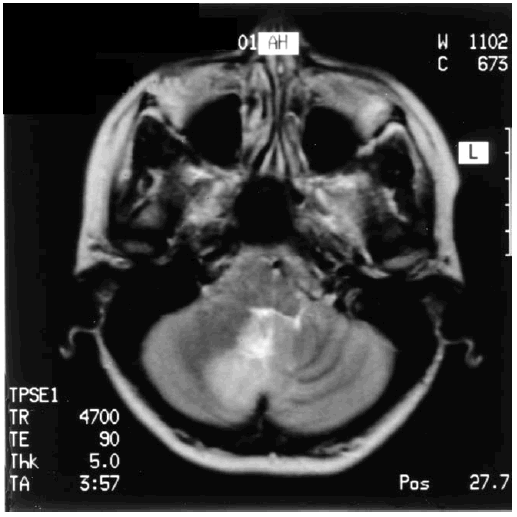 Иллюстрация к книге — Деменция. Диагностика и лечение [i_011.jpg]