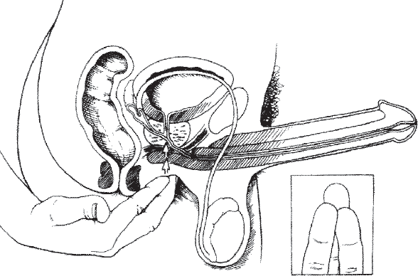 Иллюстрация к книге — Мульти-оргазмический мужчина. Как каждый мужчина может испытать множественный оргазм и сделать потрясающими свои сексуальные отношения [i_015.jpg]