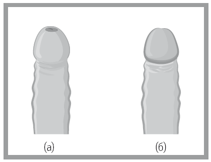 Иллюстрация к книге — «Главный» мужской орган. Медицинские исследования, исторические факты и забавные культурные феномены [i_031.jpg]