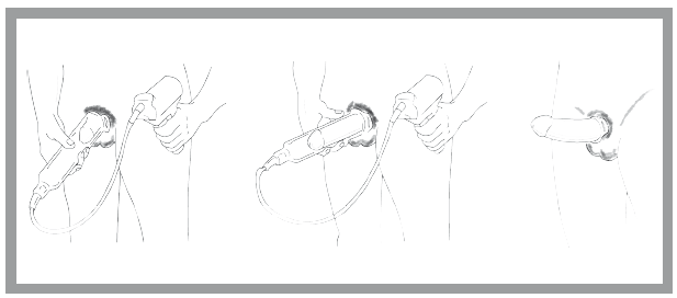 Иллюстрация к книге — «Главный» мужской орган. Медицинские исследования, исторические факты и забавные культурные феномены [i_056.jpg]