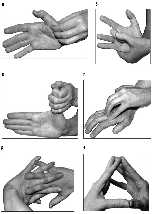 Иллюстрация к книге — Большой самоучитель исцеляющих точек. Подробный атлас, приемы и упражнения [i_166.jpg]