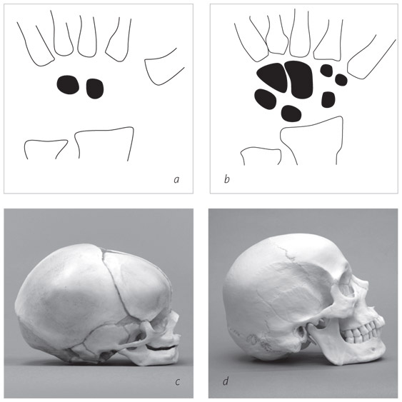 Иллюстрация к книге — Кости: внутри и снаружи [i_008.jpg]