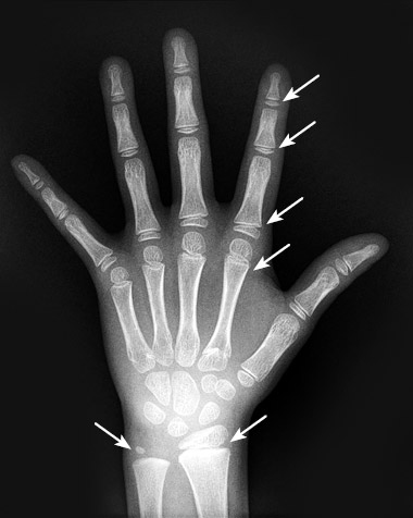 Иллюстрация к книге — Кости: внутри и снаружи [i_013.jpg]