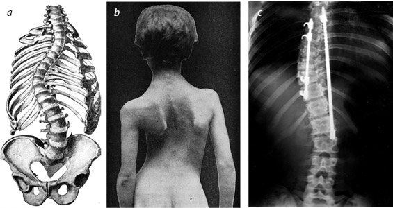 Иллюстрация к книге — Кости: внутри и снаружи [i_032.jpg]