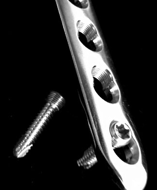 Иллюстрация к книге — Кости: внутри и снаружи [i_037.jpg]