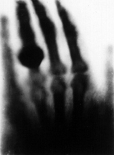 Иллюстрация к книге — Кости: внутри и снаружи [i_041.jpg]