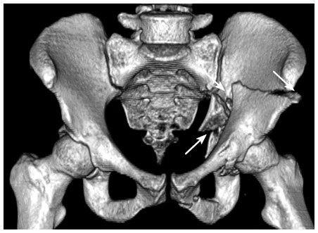 Иллюстрация к книге — Кости: внутри и снаружи [i_042.jpg]