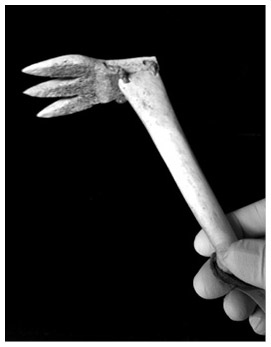 Иллюстрация к книге — Кости: внутри и снаружи [i_067.jpg]