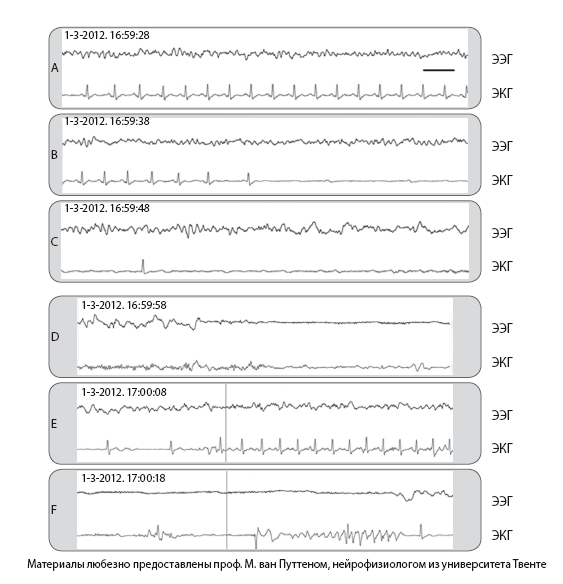 Иллюстрация к книге — Сознание за пределами жизни. Наука о жизни после смерти [i_017.jpg]