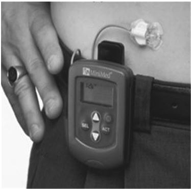 Иллюстрация к книге — Настольная книга диабетика. Как наладить жизнь с непростым диагнозом [i_048.jpg]