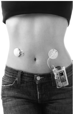 Иллюстрация к книге — Настольная книга диабетика. Как наладить жизнь с непростым диагнозом [i_052.jpg]