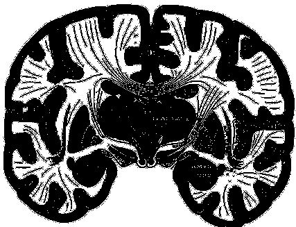 Иллюстрация к книге — По голове себе постучи. Вся правда о мигрени и другой головной боли [i_006.jpg]